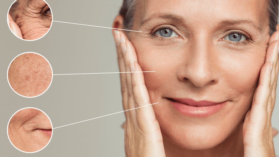 Reife Frau mit makelloser Haut und Lupen-Details zu Falten und Pigmentflecken