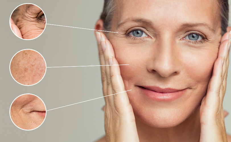 Nahaufnahme eines reifen Gesichts mit Fokus auf Falten, Pigmentflecken und Hauttextur.