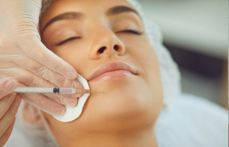 Frau erhält ästhetische Unterspritzung im unteren Gesichtsbereich durch Fachkraft