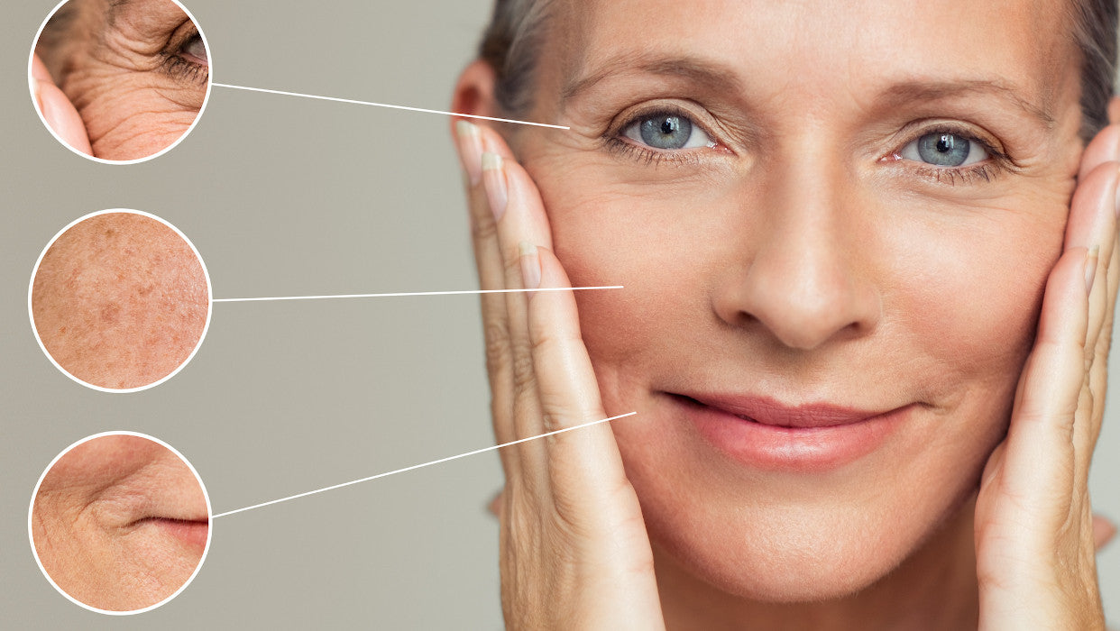 Darstellung Zonen einer Meso-Behandlung im Gesicht