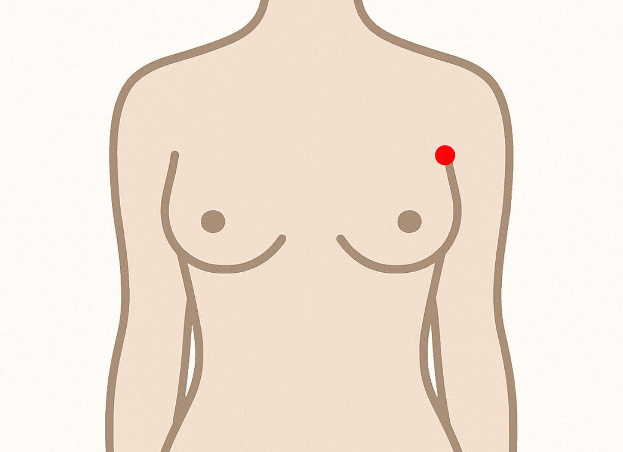 Grafik Brustvergrößerung Schnitte Implantat Achselbereich